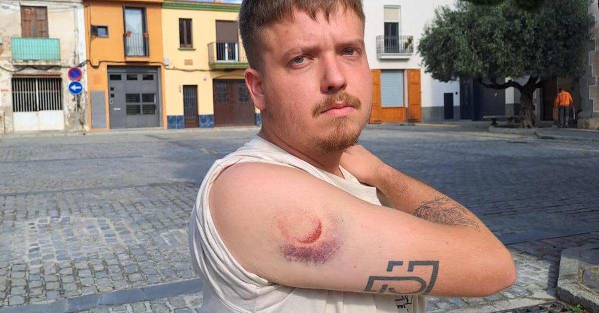 Un fotoperiodista herido por los Mossos: la investigación interna que no convence