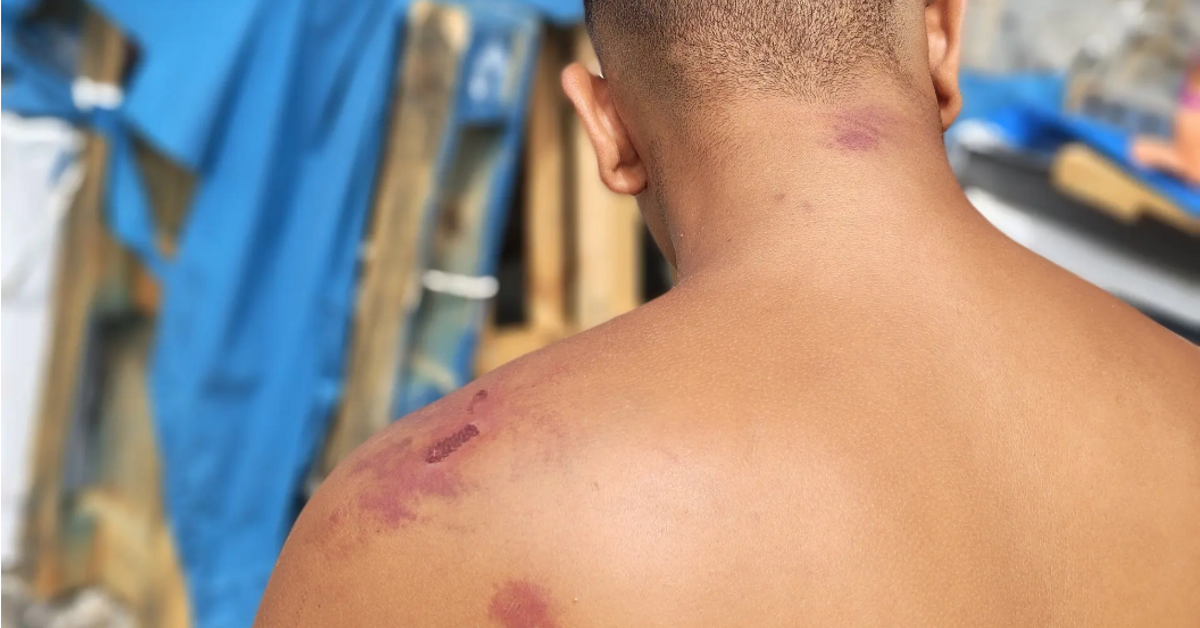 Amnistía Internacional acusa a militares españoles de torturar a migrantes en Ceuta